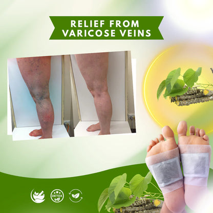 Herbal Giloy Detox Foot Patches | Body Detox Support, Stress Relief(1 BOX = 20 PATCHES-Buy 1 Get 3Free🔥🔥)